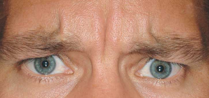 patient2-before