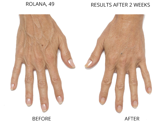 h6